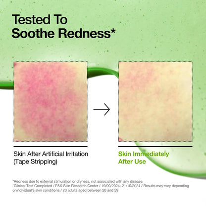 ANUA - AZELAIC ACID 10 HYALURON REDNESS SOOTHING SERUM 30ML (SUERO CON 10% ACIDO AZELAICO)
