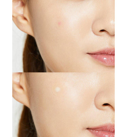 COSRX - Acne Pimple Master 24 patches (MASCARILLAS PARA GRANOS)