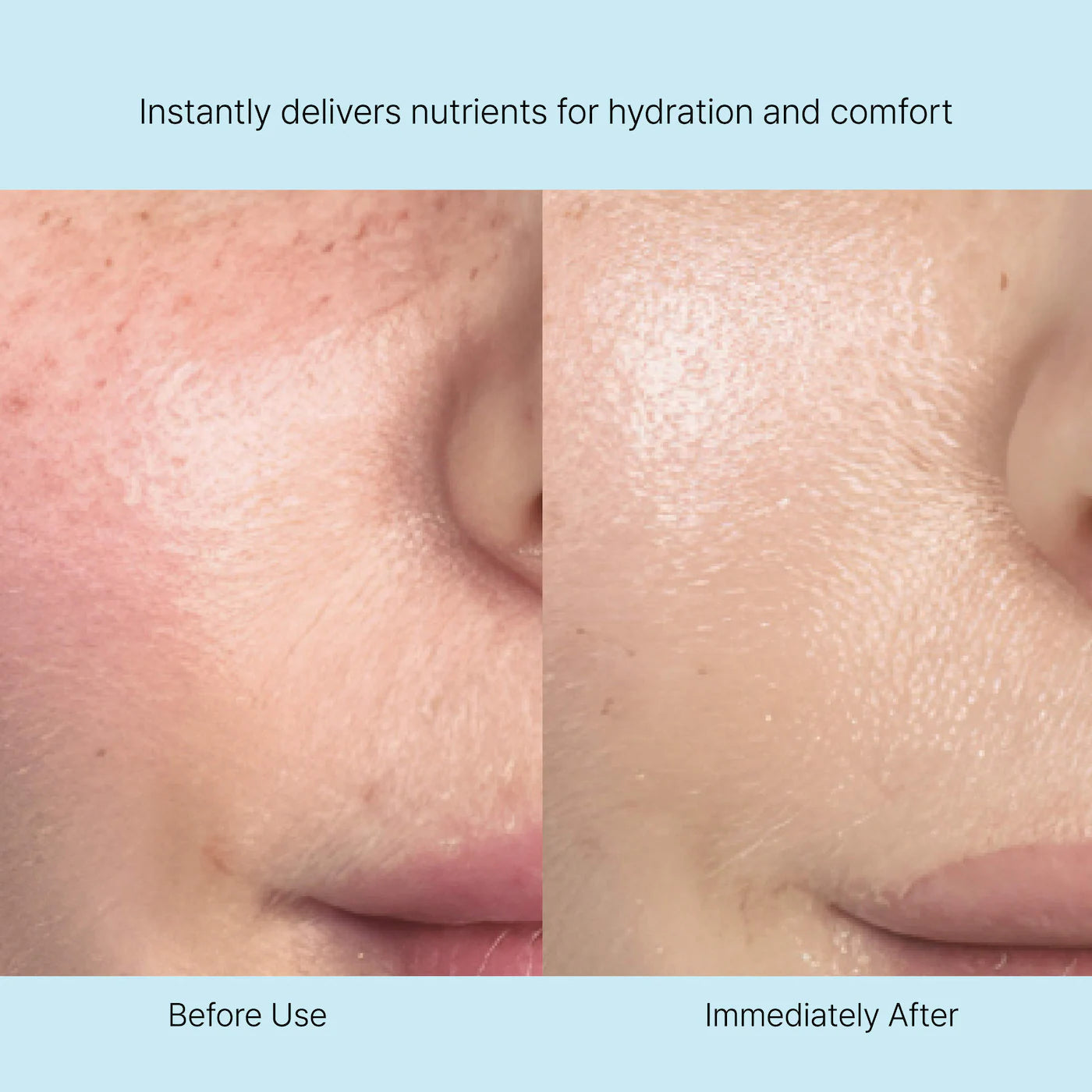 Rejuran - Nutritive Cream 50ml